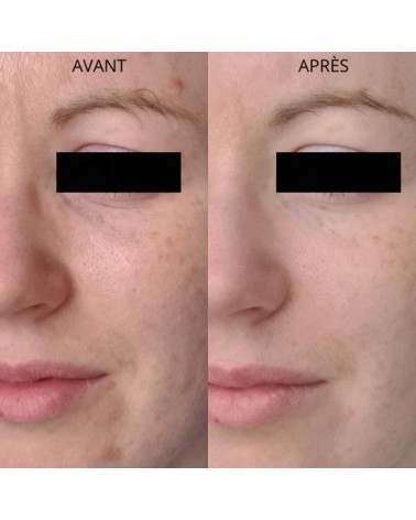 Élixir de l'Archipel - Anti-Blemish Serum With [Pre+Post]Biotics